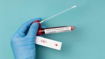 When To Take A Rapid Antigen Or RT-PCR Test For COVID-19?