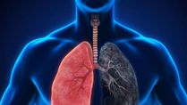 Lung Abnormalities Found In Long COVID Patients With Breathlessness: Study