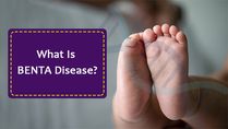 7-Month-Old Baby Diagnosed With Rare Genetic Disorder BENTA Disease: All About The Condition
