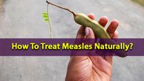 Measles Immunisation Day 2022: How To Treat Measles Naturally?