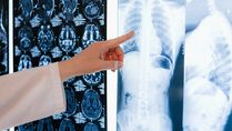 Why People With Lung Disorder Face Risk Of Severe Covid-19 Found