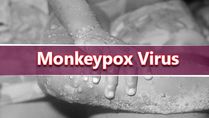 Monkeypox Virus Case Confirmed In UK After Nigeria Travel Link