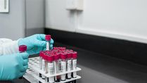 Mylab Launches RT-PCR Test For Ankylosing Spondylitis Ahead Of The World As Day
