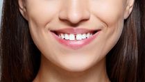 Expert Article: Gaps Between Teeth? Make Flossing And Proxa Brushing A Daily Habit