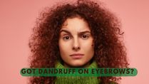 Got Dandruff On Eyebrows? Here Are 8 Simple Tips To Get Rid Of Eyebrow Dandruff