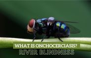 What Is Onchocerciasis, Also Called 'River Blindness'? Symptoms And Causes