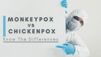 Monkeypox vs Chickenpox: Know The Difference; If You Had Chickenpox, Are You Safe?