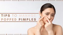 Popped That Pimple? Tips To Take Care Of It And The Surrounding Skin