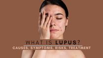 Lupus: What Causes This Autoimmune Condition? Types, Symptoms, Complications And Treatment