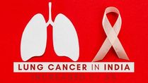 Lung Cancer In India Increased By 5%; 4 States With High Numbers