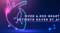 Over 6,000 Heart Patients In Maharashtra Saved By AI In The Past Two Years