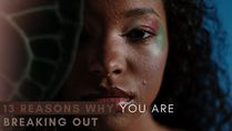 13 Reasons Why You Are Breaking Out