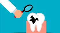 Understanding Reasons For Tooth Extraction: To Pull Or Not To Pull
