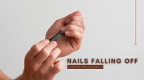 Is Your Nail Falling Off During Pregnancy? You May Have This Problem