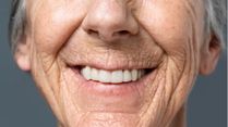 Teeth Problems That Elderly People Face And The Solutions