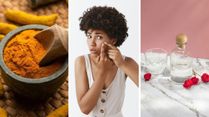Turmeric And Rose Water For Pimples And Dry Skin: 3 Ways To Use