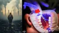 Living In High Air Pollution Cities? You Better Take Care Of Oral Health As Studies Link It To Mouth Cancer!