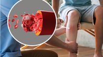 How Do You Know If A Blood Clot In Your Leg Is Life Threatening? Signs And Symptoms To Watch Out For!