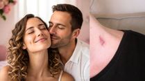 Love Bite On Your Neck? Quick Beauty, Fashion Hacks To Hide It Before Parents Or Colleagues Notice Anything!