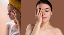 Rising Stress, Rising Skin Troubles: Why Adult Acne And Early Aging Are On The Rise