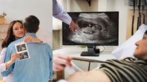 World Radiography Day 2025: Radiation vs. Reality, Ultrasound Myths And Facts Expectant Parents Should Know