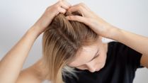 Why Your Scalp Gets Drier in Winter and What You Can Do About It