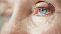 Glaucoma Awareness Month: Can You Have Eye Disease Without Symptoms?
