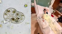 A Hidden Foodborne Infection: What You Should Know About Cyclospora