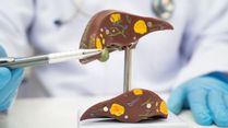 The Fatty Liver-Diabetes Link Indian Doctors Want You to Know About