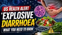 US 'Explosive Diarrhoea' Outbreak: What's Happening, How Cyclospora Spreads And Should India Be Concerned?