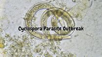 What Is Cyclospora? Inside The Parasite Outbreak Spreading Across The US
