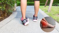 Ankle Sprains Are Rarely 