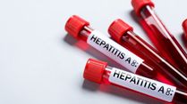 Many Indians Are Discovering Hepatitis Only During Routine Blood Tests