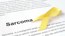 Why Young Adults Ignore Persistent Swelling for Months — And When It May Be Sarcoma