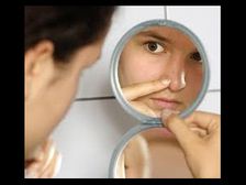 ముఖం పై నల్లమచ్చలు పోవాలంటే...!!