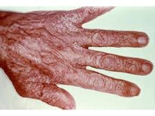 చిన్నవయసులోనే చర్మం పై ‘ముడతల’ సమస్య వేధిస్తుందా.??