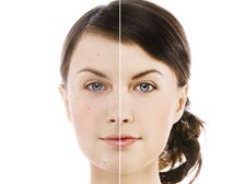 కాంతులీనే చర్మం మీ సొంతం!