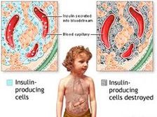 బాల్యదశలోనే షుగర్ వ్యాధి!