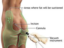 శ్రమలేకుండా బరవు తగ్గండి..?