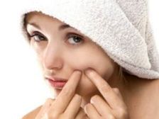 మొటిమలు చిర్రెత్తిస్తున్నాయి..?