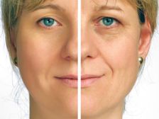 చిన్నవయస్సులోనే వయస్సు పైబడిన వారిలా కనిపిస్తున్నారా...