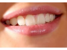 లేలేత గులాబి లాంటి పెదాల కోసం....