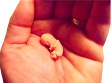 కెమికల్ అబార్షన్ అంటే?