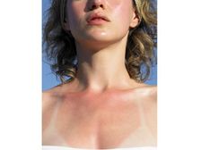 చర్మాన్ని ఎండ తీవ్రత నుండి కాపాడు కోవడం ఎలా...