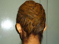 జుట్టుకు సంబంధించిన అన్నీ సమస్యల నివారణకు హెన్నా...