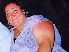 గర్భాన్ని అడ్డగించే అధిక బరువు! 