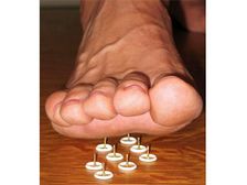 మధుమేహ నరం నొప్పి!