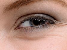 చిన్నవయస్సులోనే ముఖంపై ముడతలు...