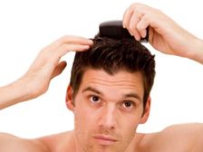 బట్టతల రాకుండా కాపాడే సహజ సిద్దమైన ఉపాయాలు...