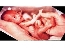 కడుపులో బేబీని మగ లేదా ఆడగా తయారు చేయండి!